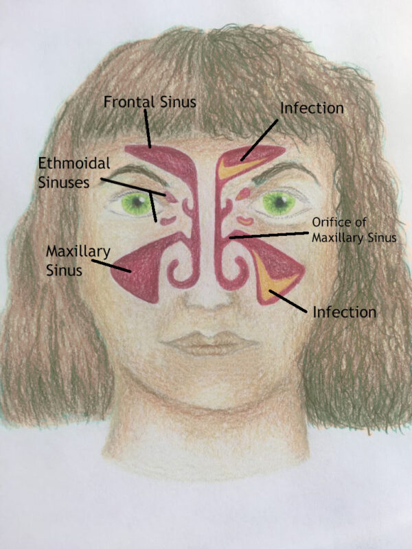 Your Sinuses | Sinus Support